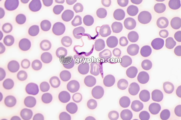 Trypanosomes dans le sang - Trypanosoma rhodiense x400 - gryphea.org